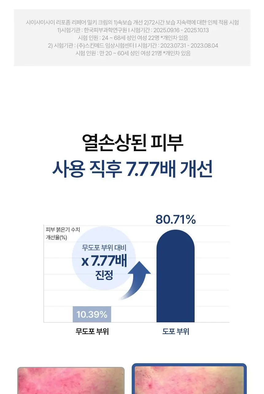 [속광화잘먹] 샤이샤이샤이 리포좀 리페어 밀키 크림 50ml 상세페이지 26